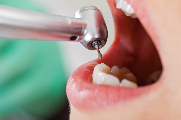 Best Broken Tooth Emergency  in Roscoe, IL